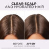 شامپو هیدرا پیور هیالورونیک مناسب موهای چرب لورال | Loreal