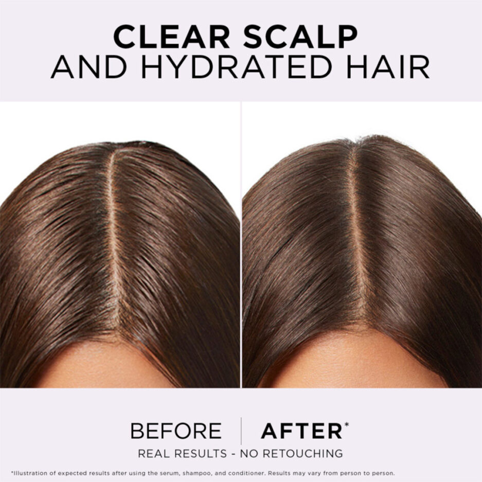 شامپو هیدرا پیور هیالورونیک مناسب موهای چرب لورال | Loreal - Image 3